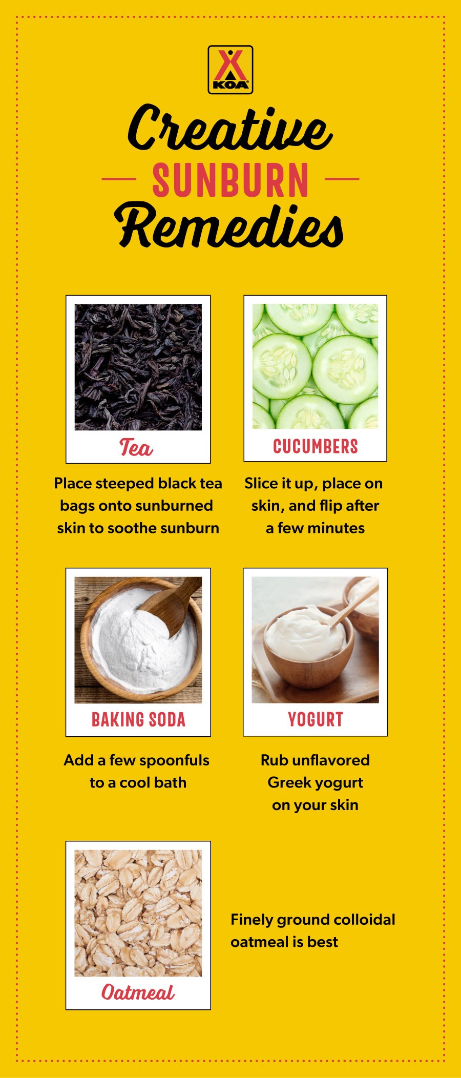 A micrographic showing creative sunburn remedies. The remedies are tea, cucumbers, baking soda, yogurt, and oatmeal. 
